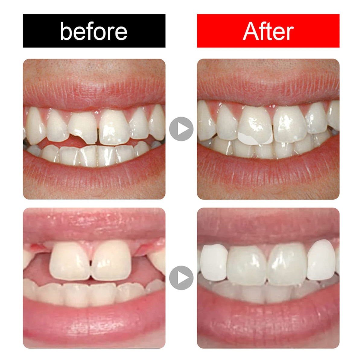 168 Pieces Acrylic Resin Denture Teeth 6 Sets 23 Shade A2 Upper + Lower N2090